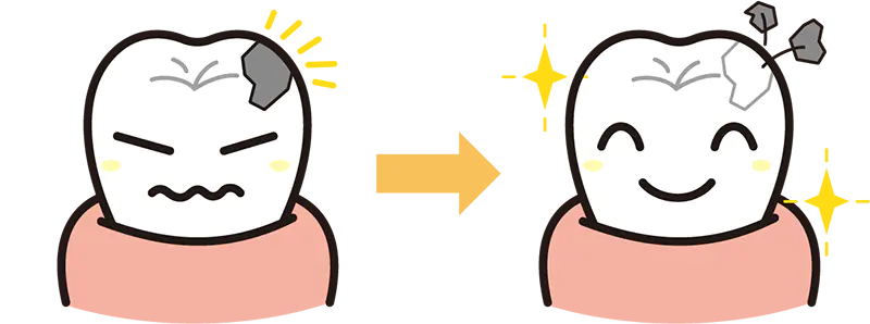 むし歯治療
